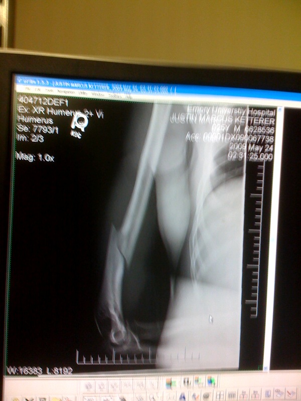 x-ray